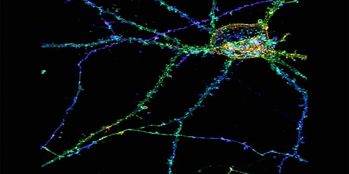 Hippocampal neuron