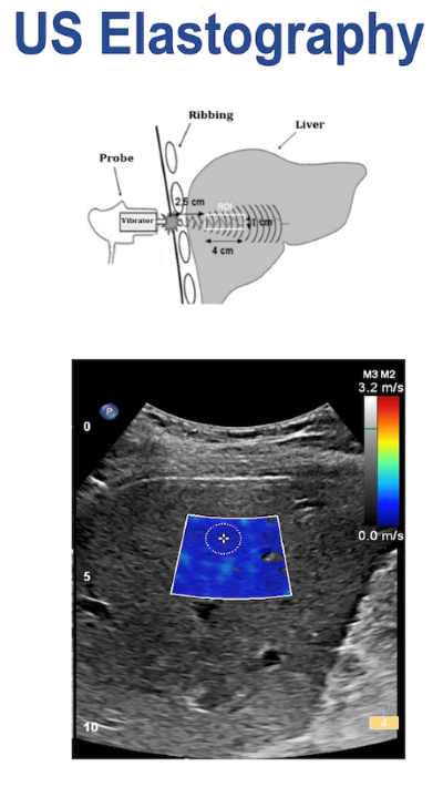 Fig3